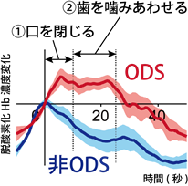 図(b) ODS患者（赤線）と非ODS患者（青線）の脳活動の違い