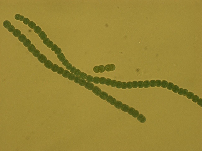 図2.アナベナ（別名ノストック）／今回の研究で使用したラン藻のひとつ。細胞が数珠状に連なり、糸状体を形成。http://2011.igem.org/File:Brown-Stanford_Anabeana.jpgより転載