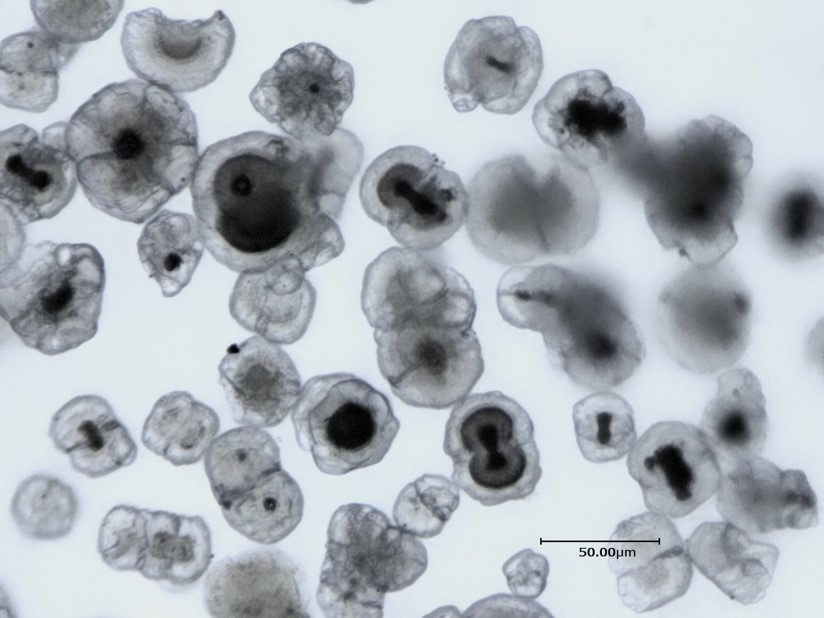 図3：マイクロドロマイト結晶中の暗黒物質：光学顕微鏡で見た暗黒物質を持つマイクロドロマイト結晶。暗黒物質の他に、海水を取り込むマイクロドロマイトもある。